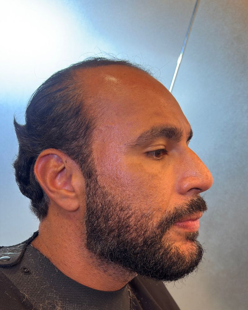 Antes